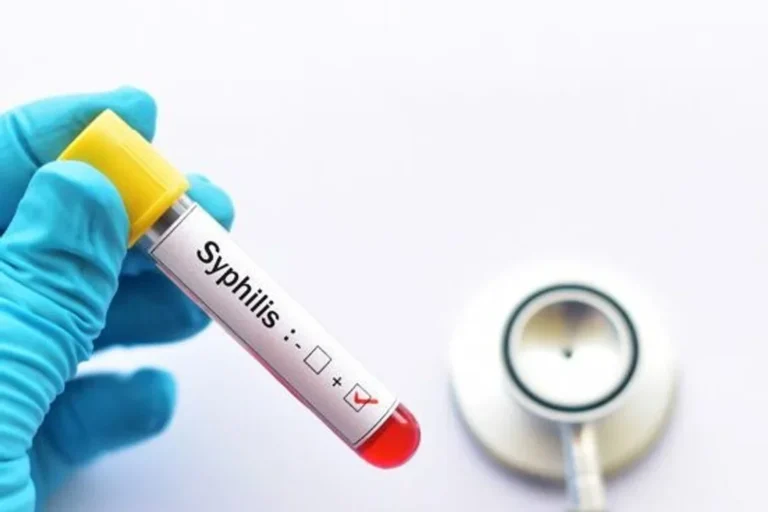 EN ARGENTINA SE REGISTRARON MÁS DE 50 MIL CASOS DE SÍFILIS